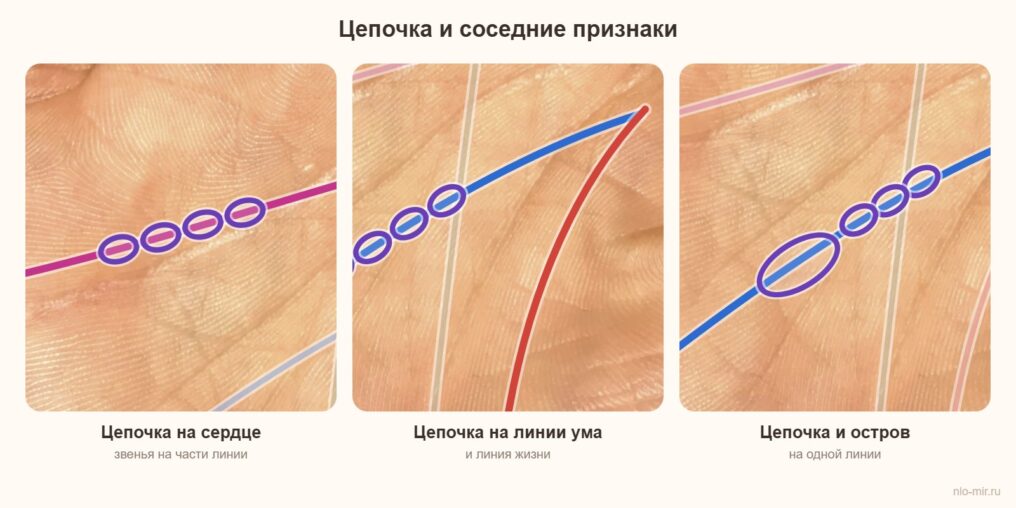 Цепочка на линии в сочетании с линией сердца, линией жизни и островом