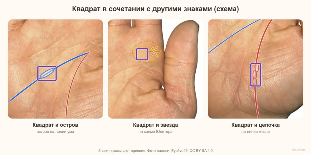 Квадрат в сочетании с островом на линии ума, звездой на холме Юпитера и цепочкой на линии жизни