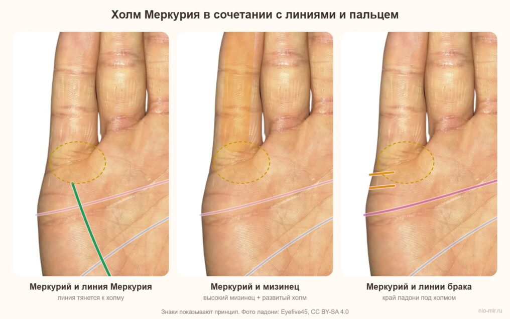 Холм Меркурия в сочетании с линией Меркурия, мизинцем и линиями брака