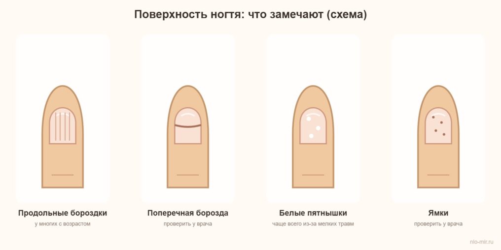Поверхность ногтя: продольные бороздки, поперечная борозда, белые пятнышки и ямки