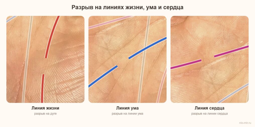 Разрыв на линии жизни, линии ума и линии сердца на ладони