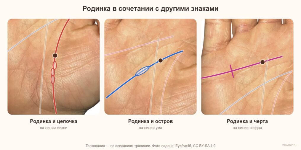 Родинка в сочетании с цепочкой на линии жизни, островом на линии ума и чертой на линии сердца