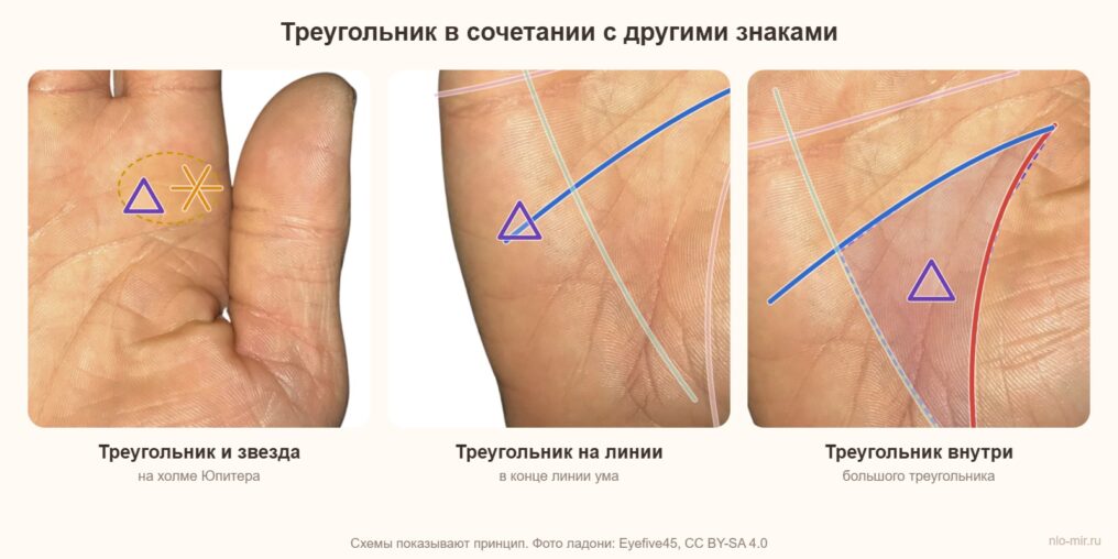 Треугольник на ладони в сочетании со звездой на холме Юпитера, на конце линии ума и внутри большого треугольника